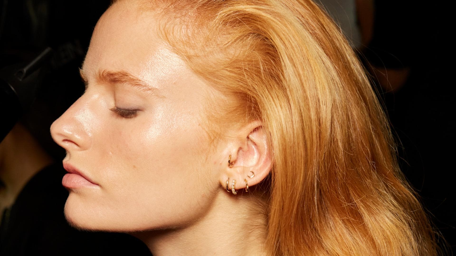 lasemd-mit-kerafactor-im-test-so-l-uft-die-behandlung-gegen-haarausfall-ab