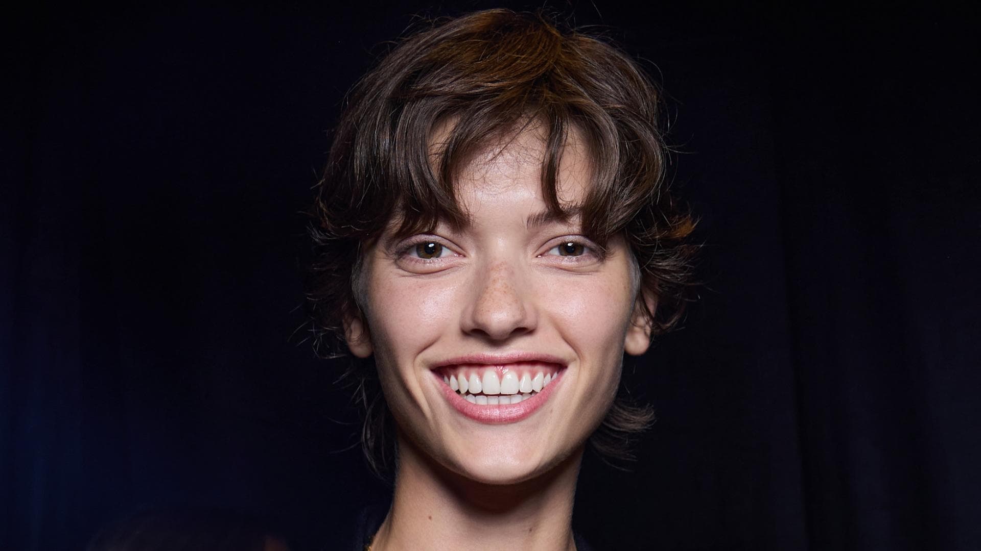 Was-bringt-Masseter-Botox-wirklich-Ich-habe-es-getestet