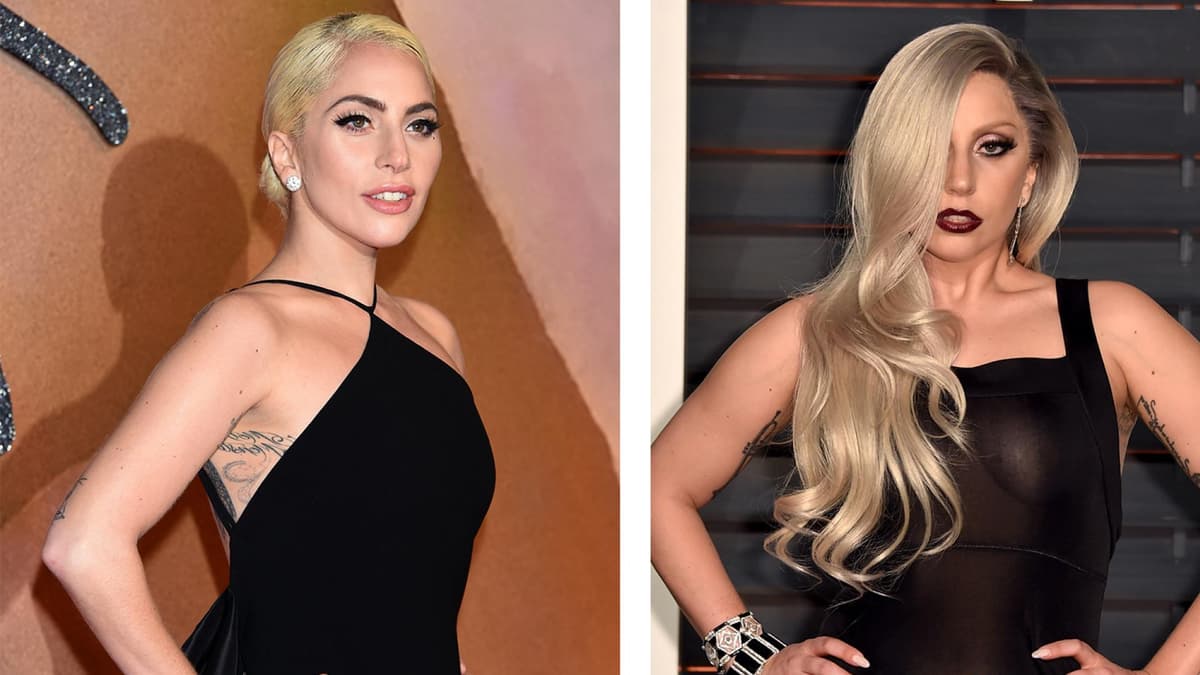 Lady Gaga Abnehmen Vorher-Nachher