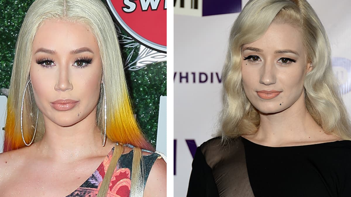 Iggy Azalea operiert und früher