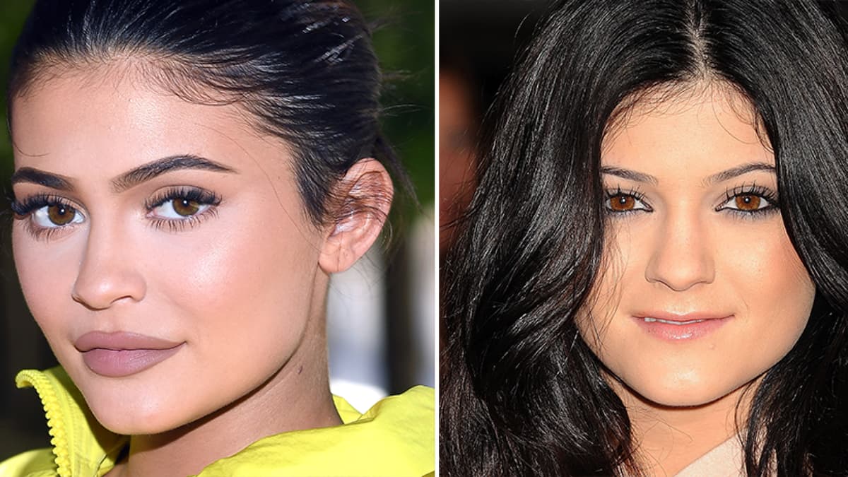 Kylie Jenner früher und heute