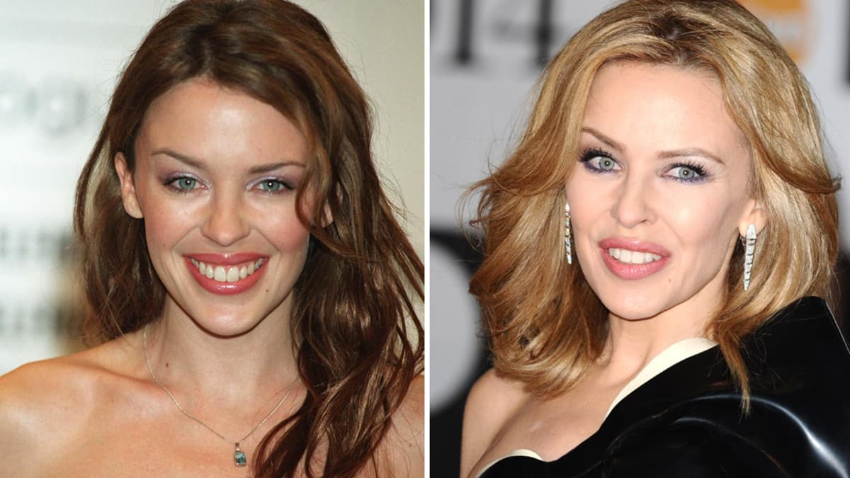 Kylie Minogue früher heute