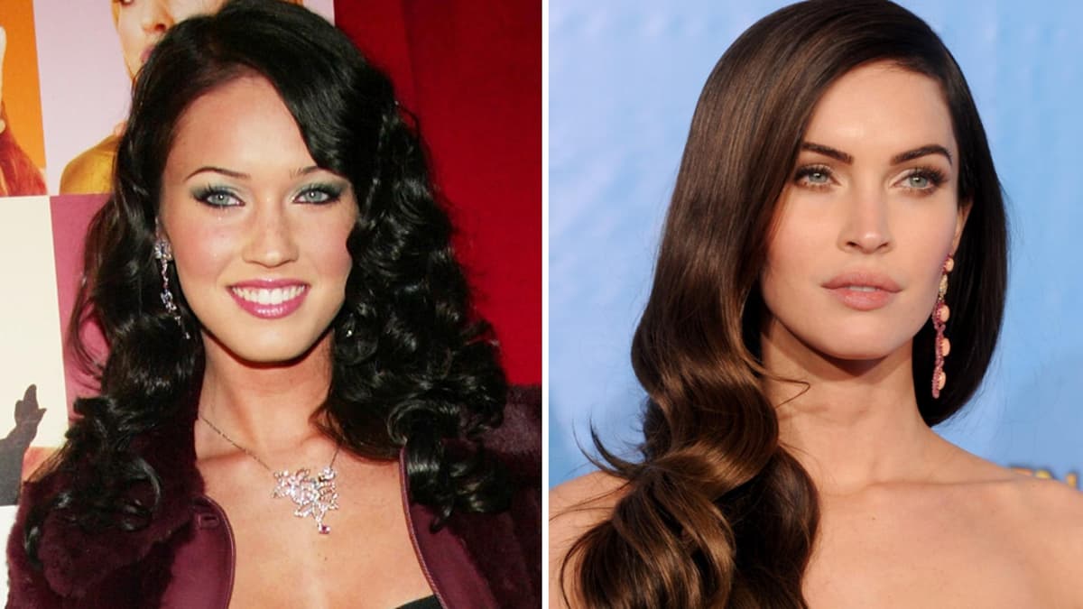 Megan Fox vor OPs und danach