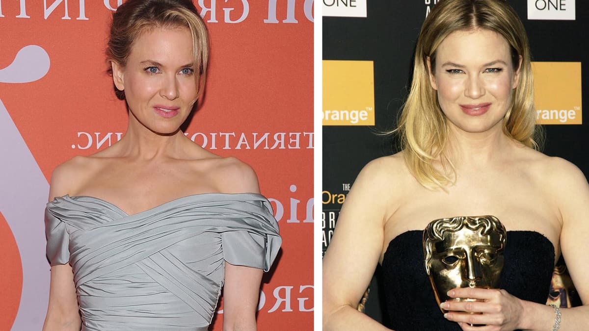 Renee Zellweger Abnehmen Vorher-Nachher