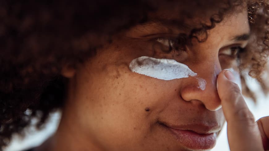 Pickel von Sonnencreme: Frau trägt sich Sonnenschutz auf das Gesicht auf