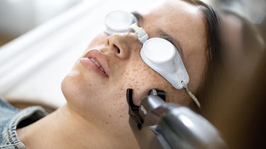 Frau testet den Alma Laser