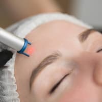 Anti-Akne Laser Behandlung Anti-Akne Laser Behandlung