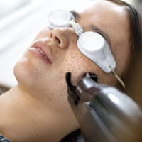 Frau testet den Alma Laser