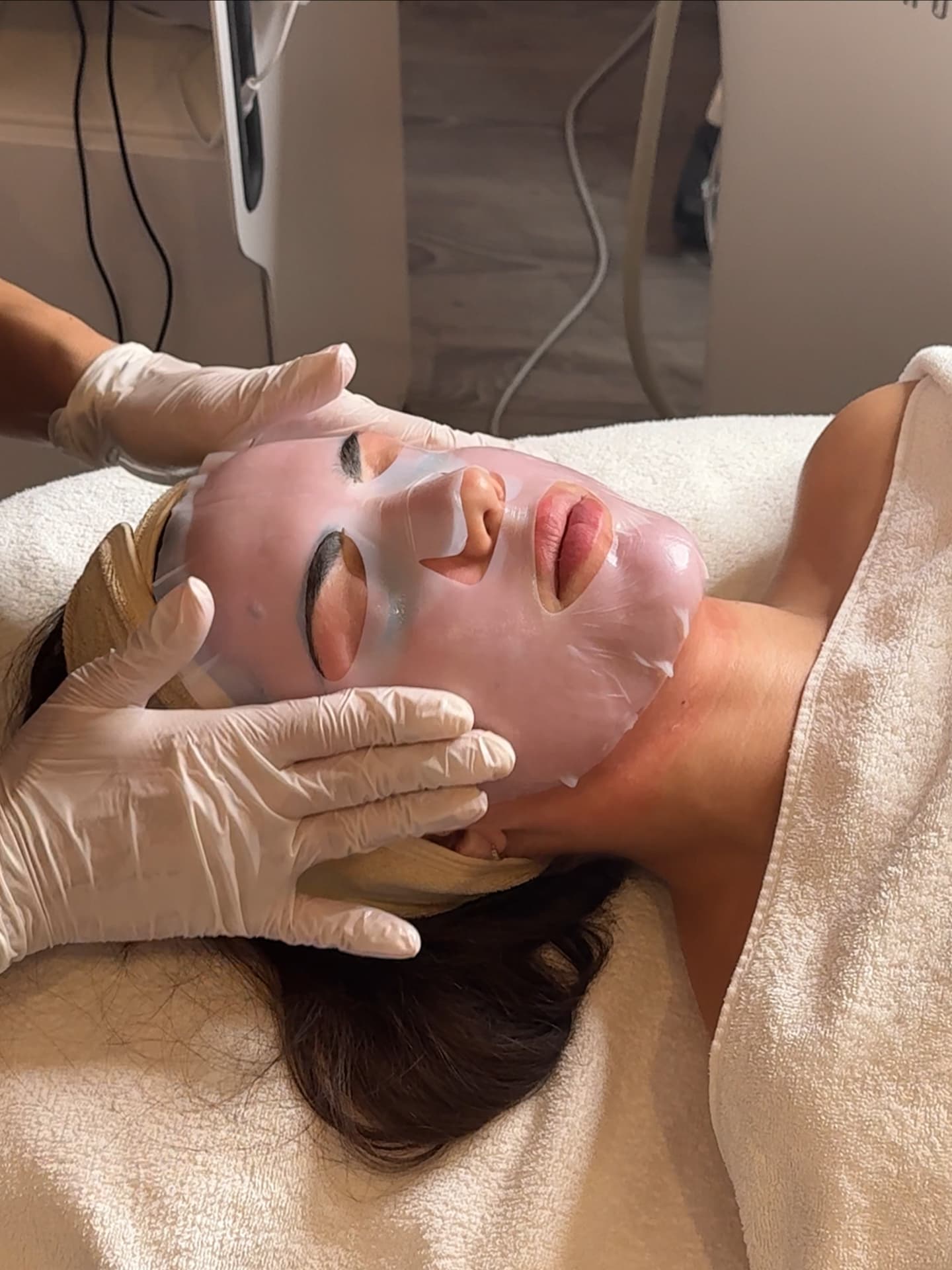 Radiofrequenz-Microneedling