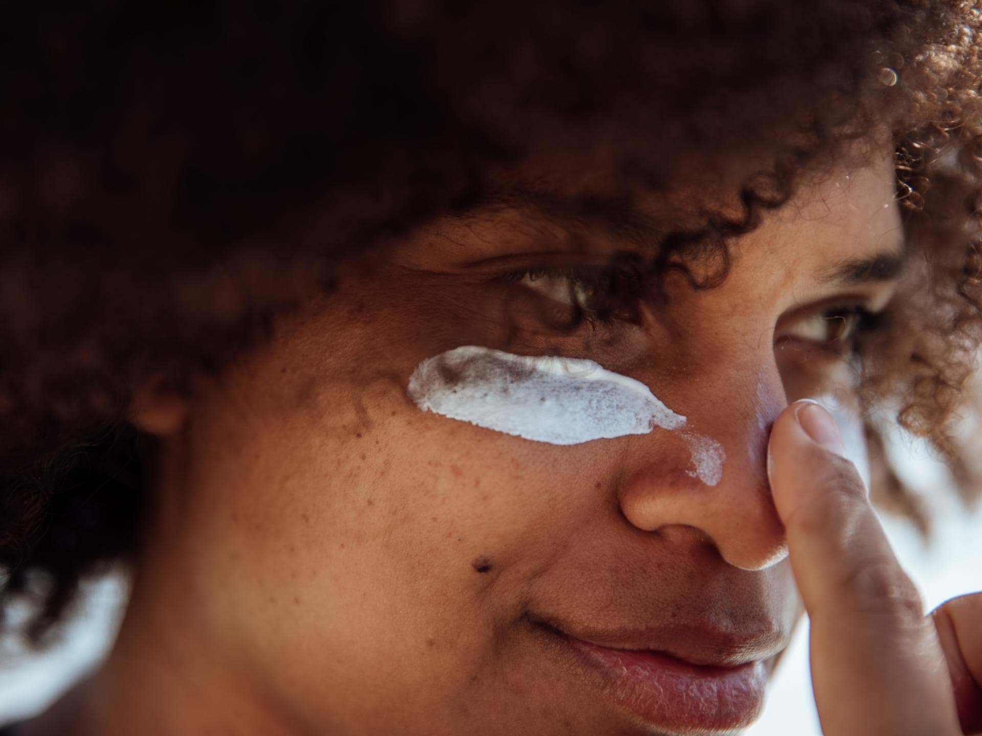 Pickel von Sonnencreme: Frau trägt sich Sonnenschutz auf das Gesicht auf