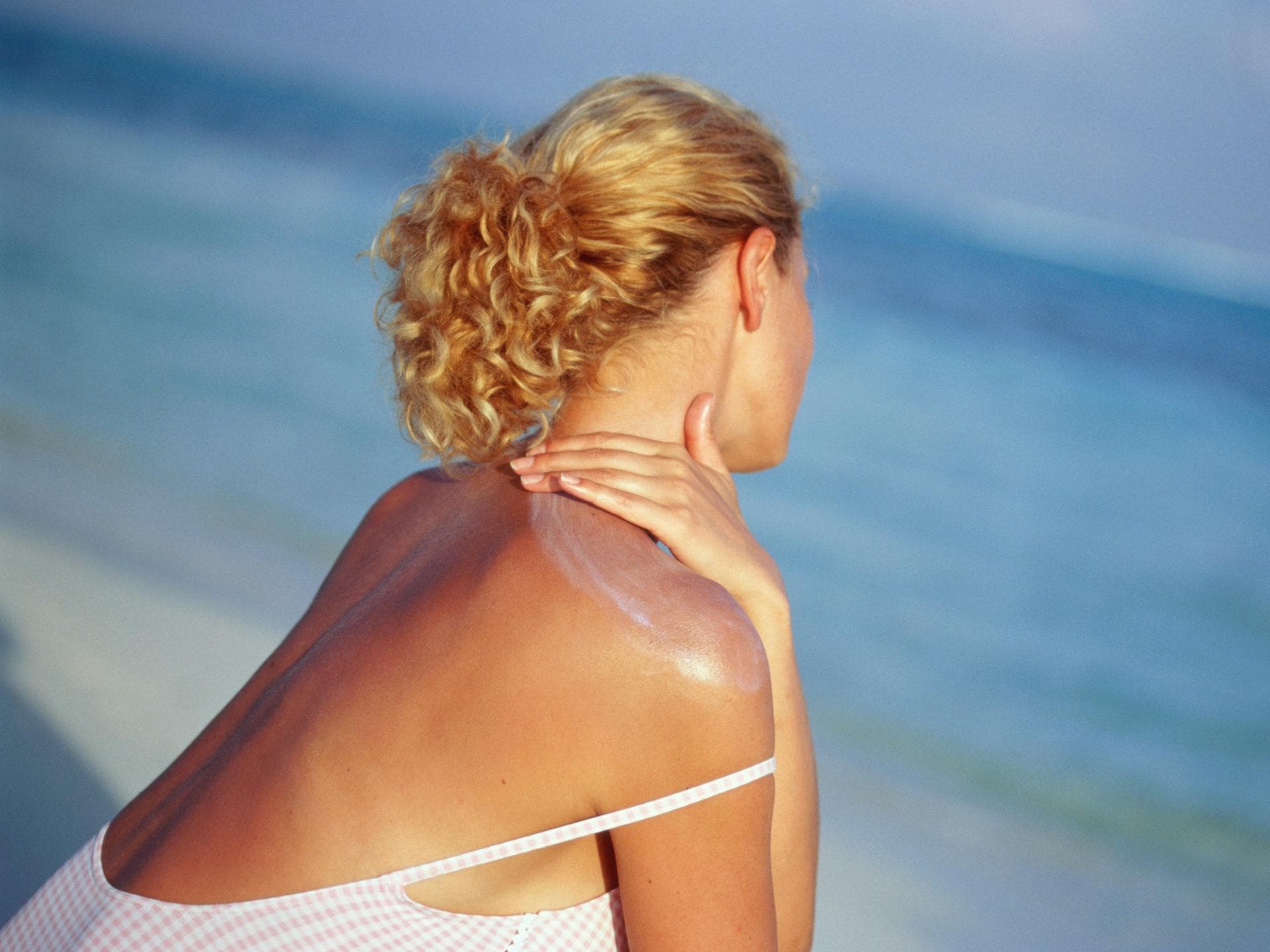 Sonnenbrand richtig behandeln Frau am Strand