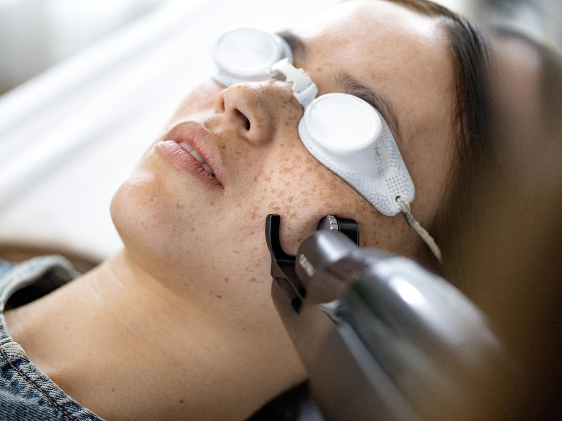 Bio-Boost Behandlung Frau testet den Alma Laser