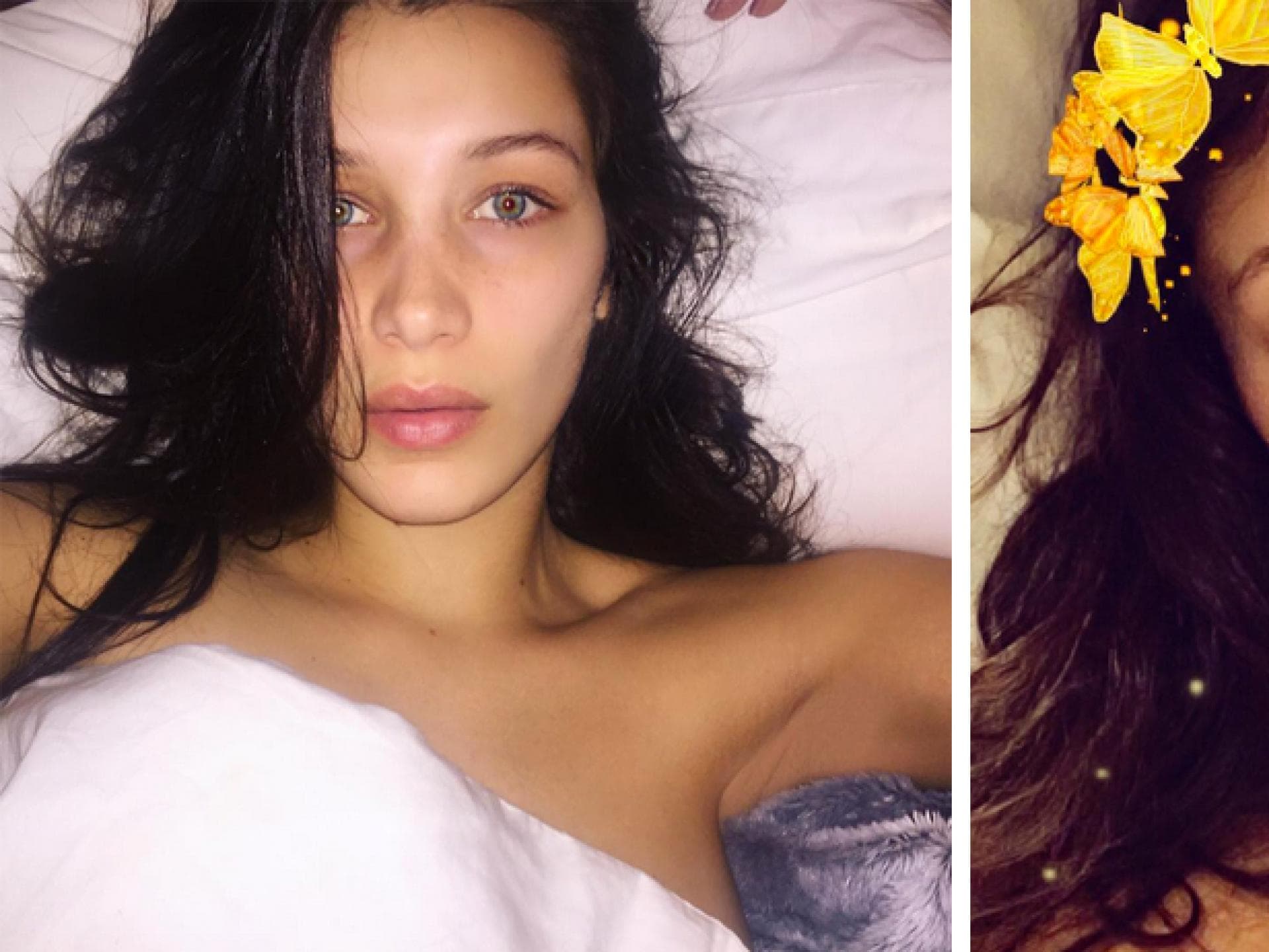 Hatte Bella Hadid eine Nasen-Op?