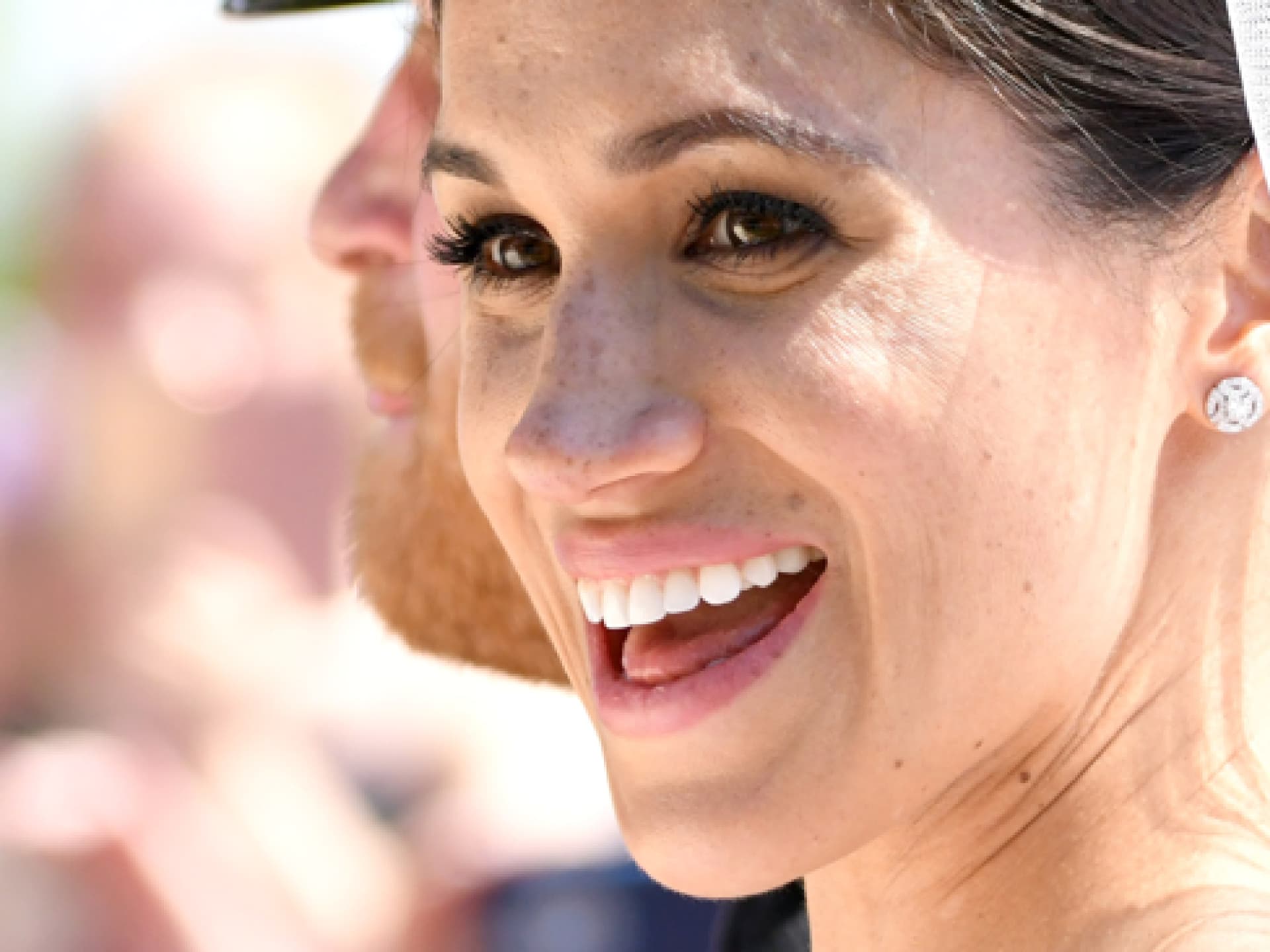 Meghan-Markle-Sommersprossen