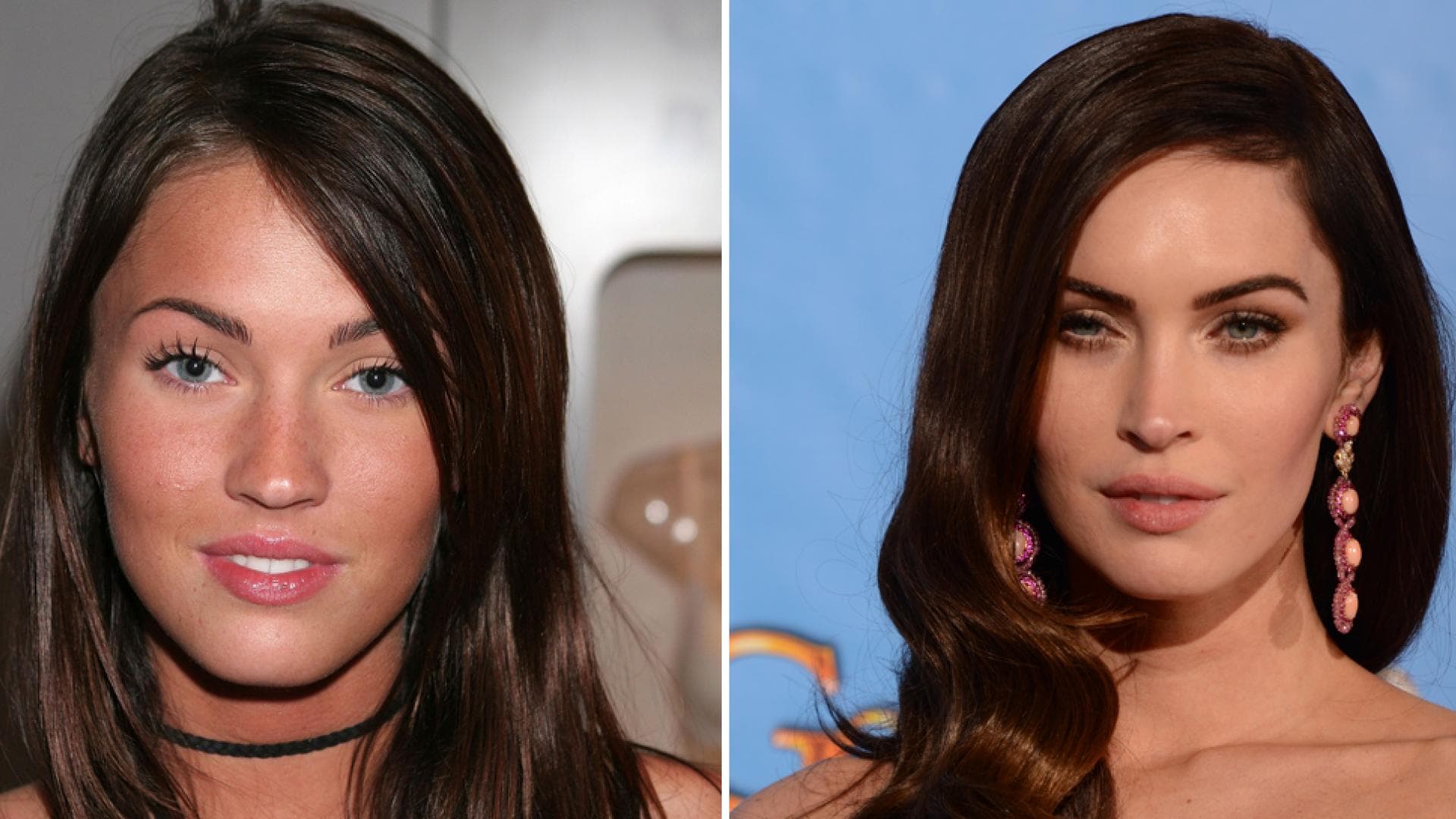 Schönheitswahn Die Stars früher & heute GRAZIA Deutschland Schönheitswahn Die Stars früher & heute GRAZIA Deutschland