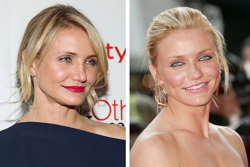 Große krumme nase frau