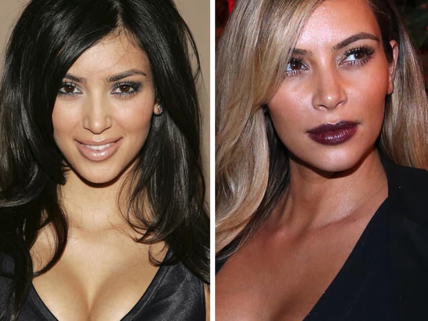 Schönheitswahn Die Stars früher & heute GRAZIA Deutschland