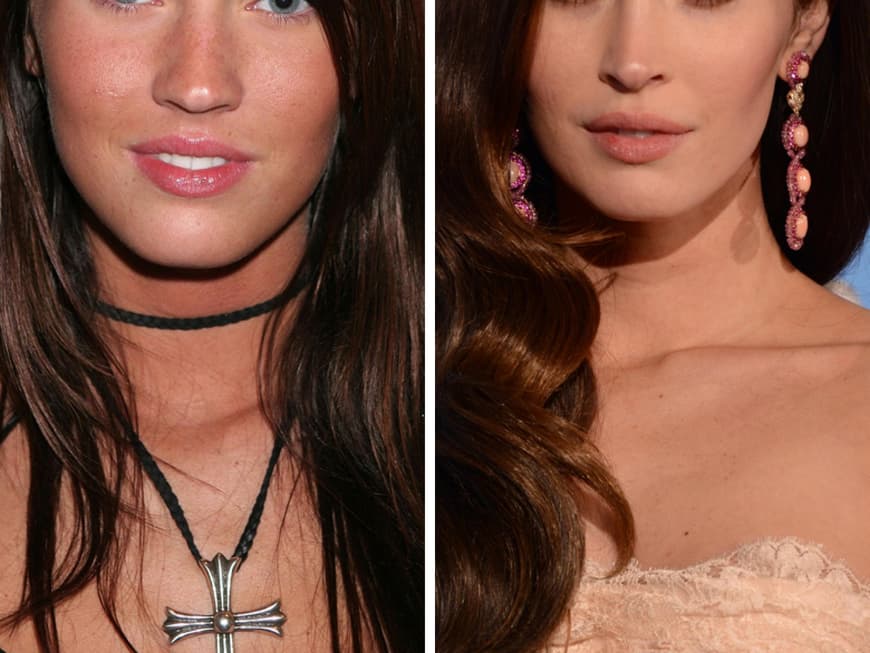 Schönheitswahn Die Stars früher & heute GRAZIA Deutschland Schönheitswahn Die Stars früher & heute GRAZIA Deutschland