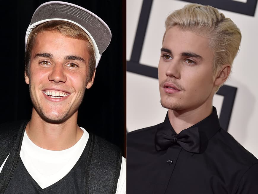 Wie Alt Ist Justin Bieber Vorher & Nachher: Diese Stars werden immer attraktiver